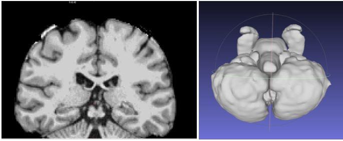 brain image